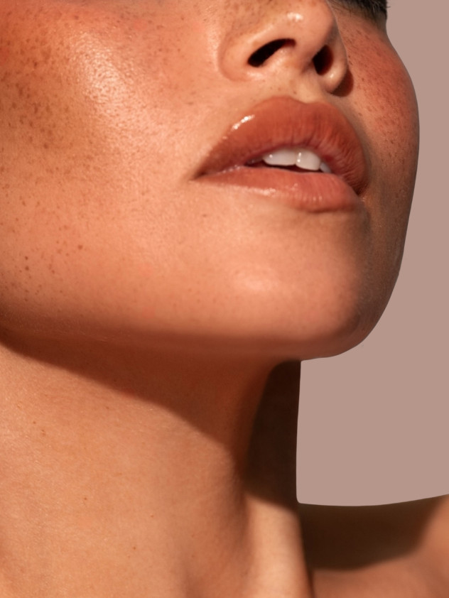 dermal fillers everbody med spa